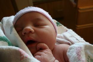 怀孕妊娠合并新生儿粘脂贮积症III型怎么对症支持 怀孕妊娠合并新生儿粘脂贮积症III型怎么对症支持